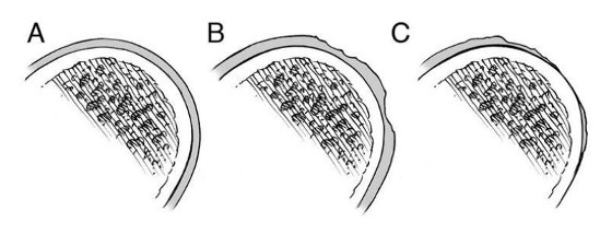 9ff0e999b2827ee9af6de27590258627_1783139266_3954.png
